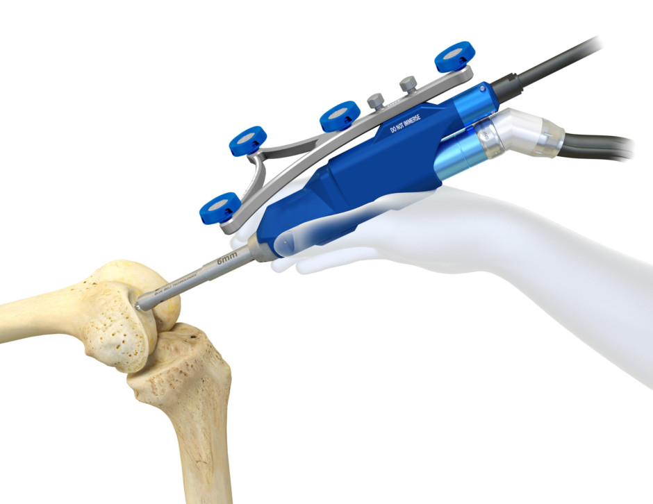 First robotic knee replacement surgery takes place in Dubai